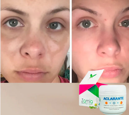 Zamia™ - Crema Aclaradora Corporal