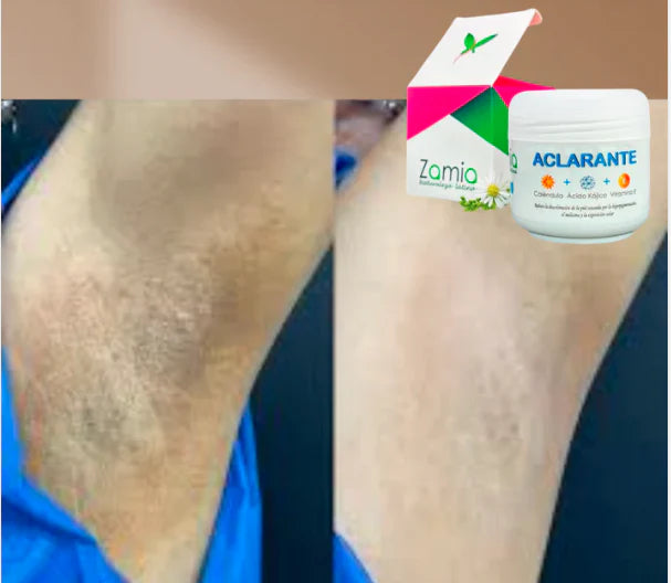 Zamia™ - Crema Aclaradora Corporal