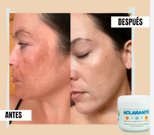Zamia™ - Crema Aclaradora Corporal