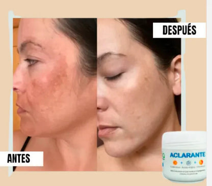 Zamia™ - Crema Aclaradora Corporal