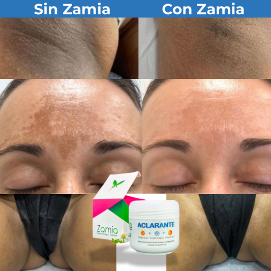 Zamia™ - Crema Aclaradora Corporal1